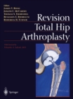 Revision Total Hip Arthroplasty - eBook