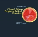 Clinical Atlas of Peripheral Retinal Disorders - eBook
