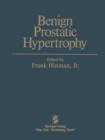 Benign Prostatic Hypertrophy - Book