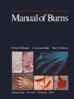 Manual of Burns - eBook
