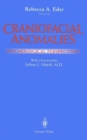 Craniofacial Anomalies : Psychological Perspectives - Book