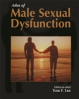 Atlas of Male Sexual Dysfunction - eBook