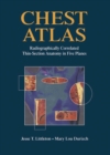 Chest Atlas : Radiographically Correlated Thin-Section Anatomy in Five Planes - eBook