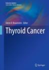 Thyroid Cancer - Book