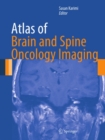 Atlas of Brain and Spine Oncology Imaging - eBook