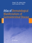 Atlas of Dermatological Manifestations of Gastrointestinal Disease - eBook