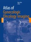 Atlas of Gynecologic Oncology Imaging - Book