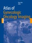 Atlas of Gynecologic Oncology Imaging - eBook