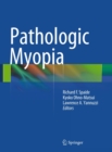 Pathologic Myopia - eBook