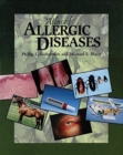 Atlas of Allergic Diseases - Book