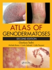 Atlas of Genodermatoses - eBook