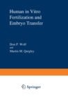 Human in Vitro Fertilization and Embryo Transfer - Book