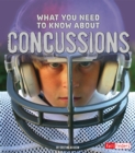 What You Need to Know about Concussions - eBook