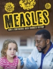 Measles : How a Contagious Rash Changed History - Book