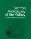 Electron Microscopy of the Kidney : In Renal Disease and Hypertension: A Clinicopathological Approach - Book