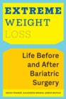 Extreme Weight Loss : Life Before and After Bariatric Surgery - Book
