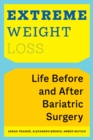 Extreme Weight Loss : Life Before and After Bariatric Surgery - eBook