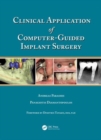 Clinical Application of Computer-Guided Implant Surgery - Book