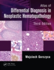 Atlas of Differential Diagnosis in Neoplastic Hematopathology - Book