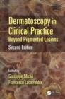 Dermatoscopy in Clinical Practice : Beyond Pigmented Lesions - Book