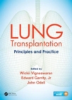 Lung Transplantation : Principles and Practice - Book