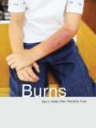 Burns - Book