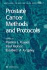 Prostate Cancer Methods and Protocols - Book