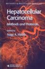 Hepatocellular Carcinoma : Methods and Protocols - Book