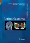 Retinoblastoma - Book