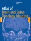 Atlas of Brain and Spine Oncology Imaging - Book