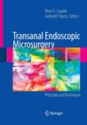 Transanal Endoscopic Microsurgery : Principles and Techniques - Book