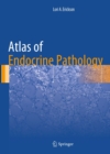Atlas of Endocrine Pathology - eBook