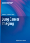 Lung Cancer Imaging - Book
