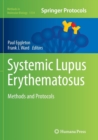 Systemic Lupus Erythematosus : Methods and Protocols - Book