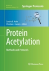 Protein Acetylation : Methods and Protocols - Book