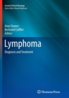 Lymphoma : Diagnosis and Treatment - Book