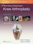 Master Techniques in Orthopedic Surgery: Knee Arthroplasty - Book