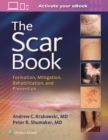 The Scar Book : Formation, Mitigation, Rehabilitation and Prevention - Book