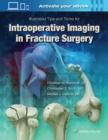 Illustrated Tips and Tricks for Intraoperative Imaging in Fracture Surgery - Book