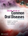 Color Atlas of Common Oral Diseases - Book