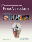 Master Techniques in Orthopedic Surgery: Knee Arthroplasty - eBook
