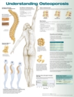 Understanding Osteoporosis Anatomical Chart - Book