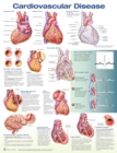 Cardiovascular Disease Anatomical Chart - Book