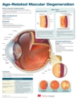 Age-Related Macular Degeneration Anatomical Chart - Book