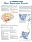 Understanding Major Depressive Disorder - Book