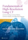 Fundamentals of High-Resolution Lung CT : Common Findings, Common Patterns, Common Diseases and Differential Diagnosis - Book