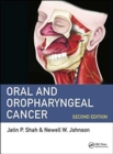 Oral and Oropharyngeal Cancer - Book