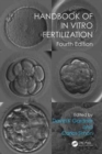 Handbook of In Vitro Fertilization - Book