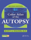 Color Atlas of the Autopsy - eBook