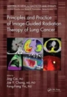 Principles and Practice of Image-Guided Radiation Therapy of Lung Cancer - Book